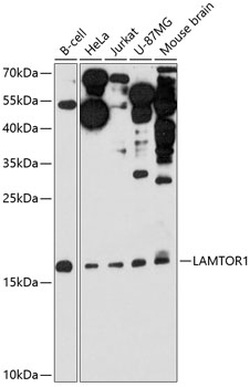 Anti-LAMTOR1 Antibody