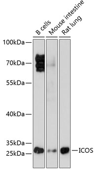 Anti-ICOS Antibody