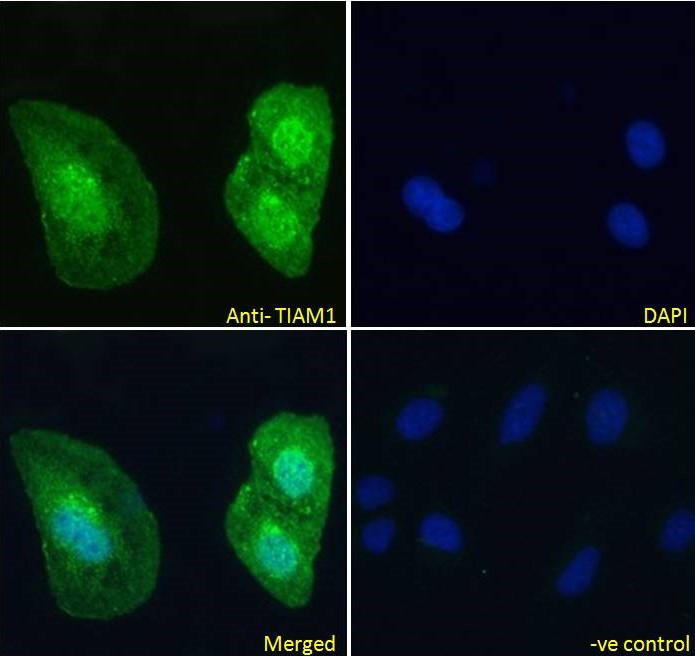 Anti-TIAM1 Antibody