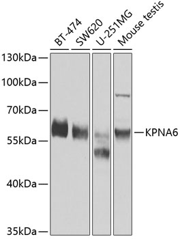 Anti-KPNA6 Antibody