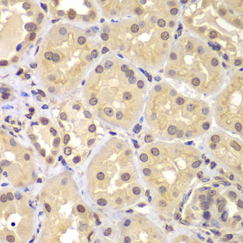 Anti-KPNA6 Antibody