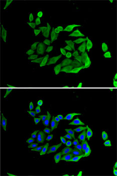 Anti-HPSE Antibody
