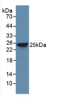 Western Blot; Sample: Recombinant Bax, Rat.