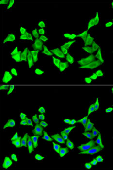 Anti-PTH Antibody