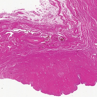 Human Vagina, sec. 7 µm H&E Microscope Slide