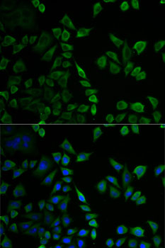 Anti-MSLN Antibody