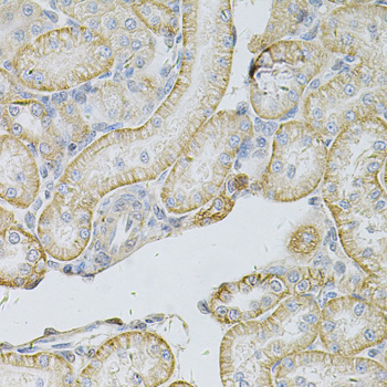 Anti-MSLN Antibody