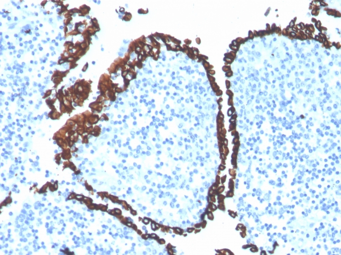 Anti-Cytokeratin 5 Antibody [KRT5/4245R]