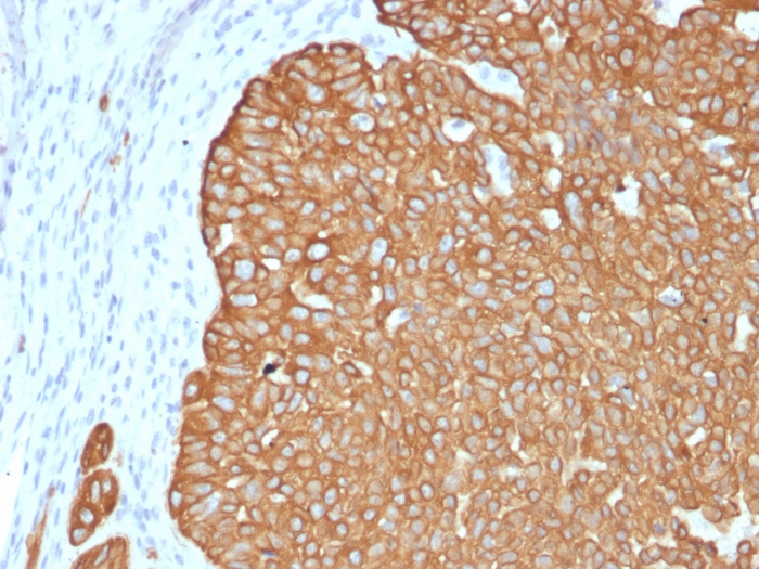 Anti-Cytokeratin 5 Antibody [KRT5/4245R]