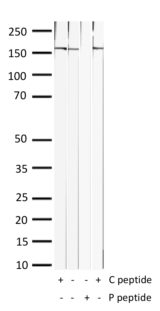 Western Blot of 10ug liver lysates from mouse (lanes 1 and 2) and rat (lanes 3 and 4) stained with EGFR-pS1046 Rabbit Polyclonal Antibody AE00305 at 1ug/ml (overnight at 4℃) in the presence (+) or absence (-) of its antigen (P peptide) or its non-phosphorylated control (C peptide). ECL staining by HRP.