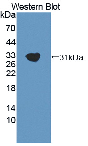 Western Blot; Sample: Recombinant protein.