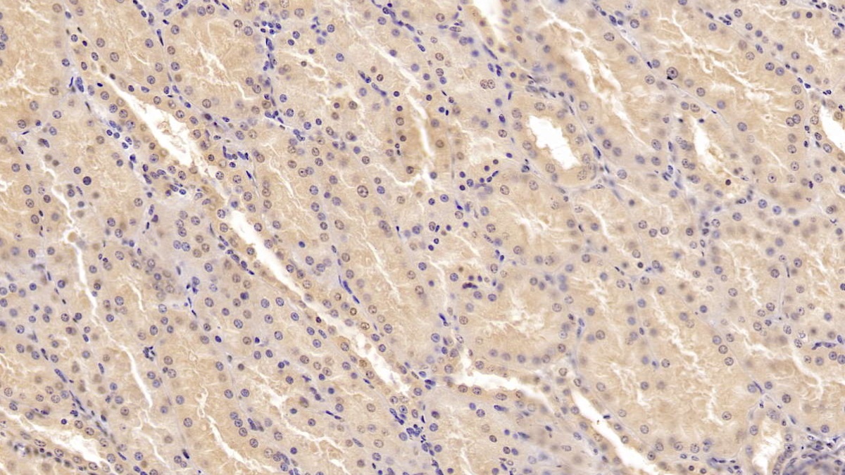 DAB staining on IHC-P; Sample: Human Kidney Tissue;  Primary Ab: 20µg/ml Mouse Anti-Human MSRA Antibody Second Ab: 2µg/mL HRP-Linked Caprine Anti-Mouse IgG Polyclonal Antibody (Catalog: SAA544Mu19)