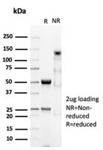 SDS-PAGE analysis of purified, BSA-free CD74 antibody (clone CLIP/7023R) as confirmation of integrity and purity.