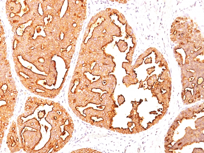 Anti-MUC1 Antibody [MUC1/967] - BSA and Azide free