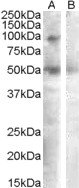 Anti-SULF2 Antibody