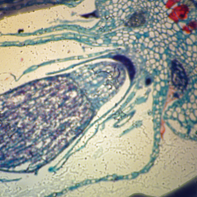Marchantia Sporophyte, l.s., 12 µm Microscope Slide