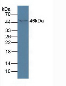 Western Blot; Sample:Human Serum.