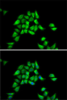 Anti-DCTN1 Antibody