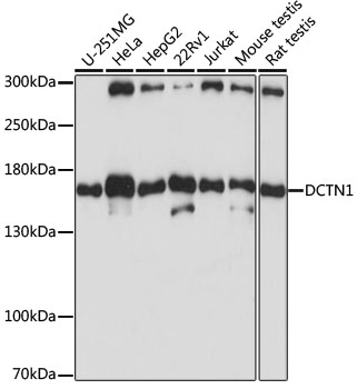 Anti-DCTN1 Antibody