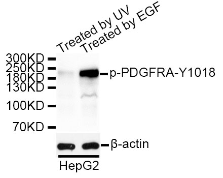 Anti-PDGFRA (phospho Y1018) Antibody