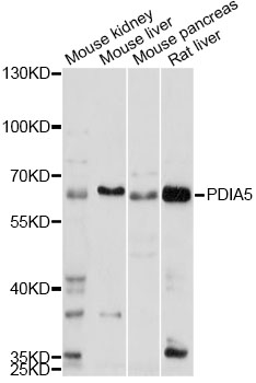 Anti-PDIA5 Antibody