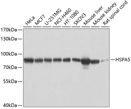 Anti-HSPA5 Antibody