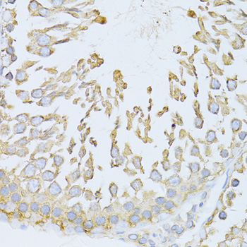 Anti-HSPA5 Antibody