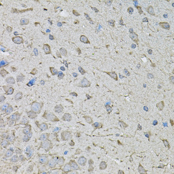 Anti-CDK10 Antibody