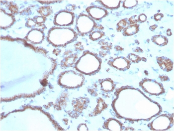 IHC staining of FFPE human thyroid with DBC2 antibody. HIER: boil tissue sections in pH 9 10mM Tris with 1mM EDTA for 20 min and allow to cool before testing.