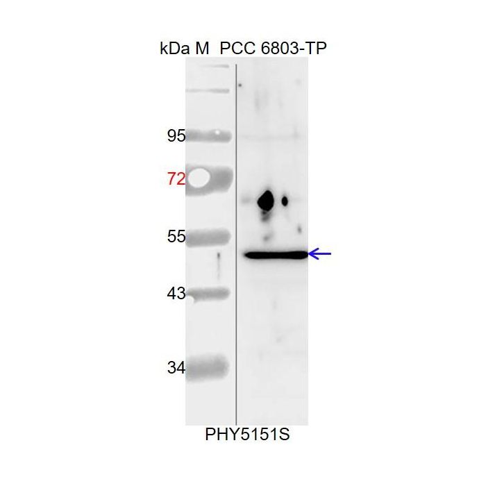 GlgA1 / Anti-Glycogen Synthase 1 Antibody
