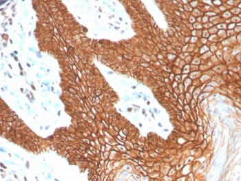 IHC staining of FFPE human cervix with recombinant E-Cadherin antibody (clone CDH1/4398R). HIER: boil tissue sections in pH 9 10mM Tris with 1mM EDTA for 20 min and allow to cool before testing.