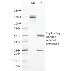 SDS-PAGE analysis of purified, BSA-free Cytokeratin 20 antibody (clone SPM191) as confirmation of integrity and purity.