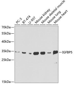 Anti-IGFBP5 Antibody
