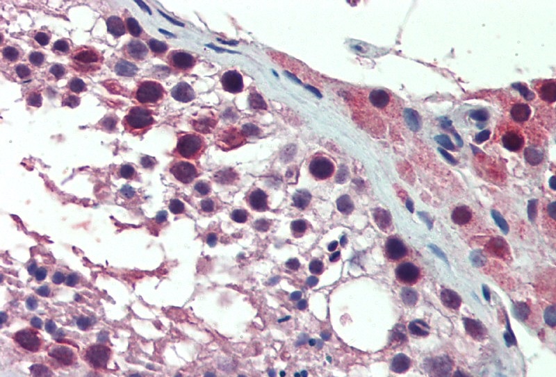 Anti-PREX1 Antibody