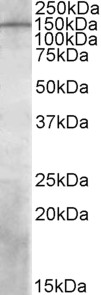 Anti-PREX1 Antibody