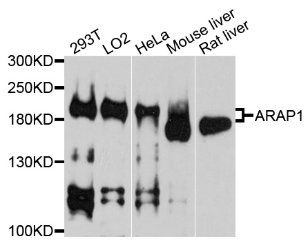 Anti-ARAP1 Antibody