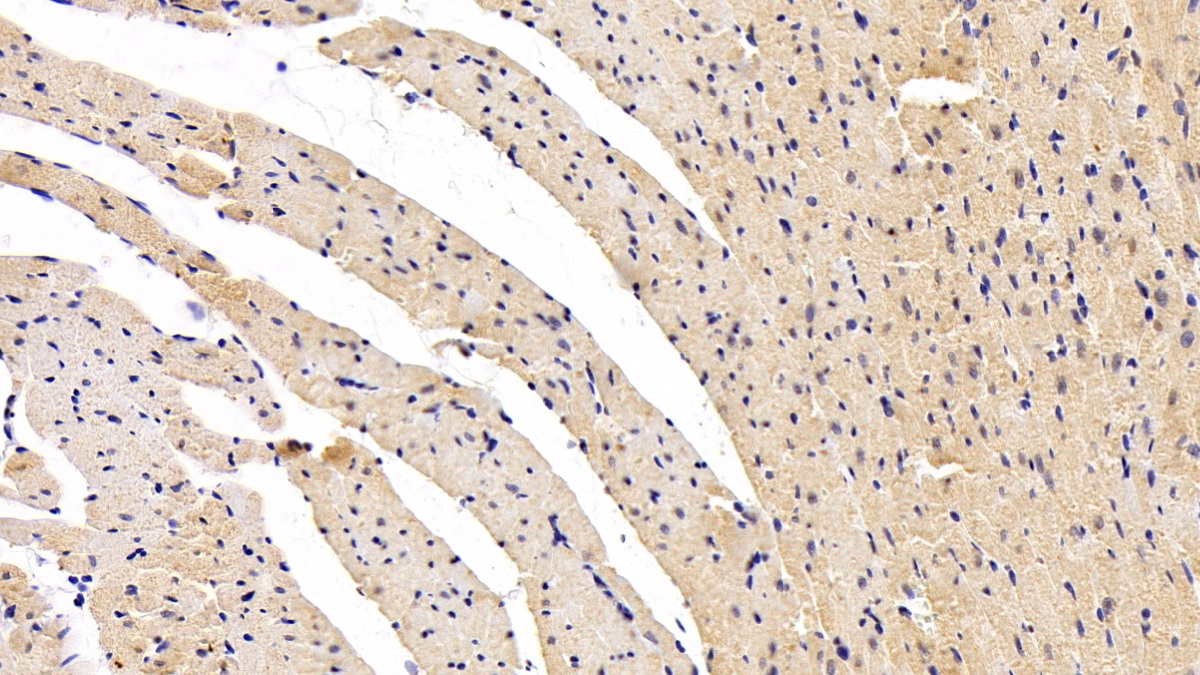 DAB staining on IHC-P; Sample: Rat Cardiac Muscle Tissue;  Primary Ab: 30µg/ml Mouse Anti-Rat BNP Antibody Second Ab: 2µg/mL HRP-Linked Caprine Anti-Mouse IgG Polyclonal Antibody (Catalog: SAA544Mu19)