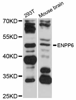 Anti-ENPP6 Antibody