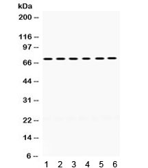 Western blot testing of mouse 1) brain, 2) liver, 3) thymus, 4) testis, 5) human 293 and 6) HeLa lysate with LIMK2 antibody. Expected/observed molecular weight ~72 kDa.