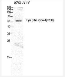 Western Blot analysis of LOVO+UV cells using Phospho-Fyn (Y530) Polyclonal Antibody diluted at 1:2000