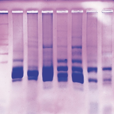 Fish Protein Fingerprinting on Agarose Gels Kit (with Prepaid Coupon)