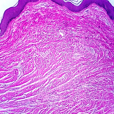 Human Keratinized Epithelium, Microscope Slide
