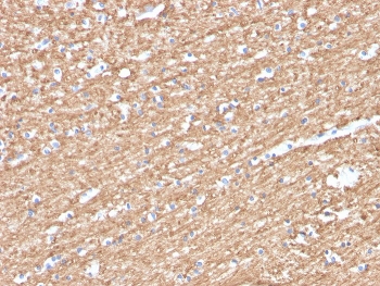 IHC staining of FFPE human brain with Myelin Basic Protein antibody (clone MBP/4276). HIER: boil tissue sections in pH 9 10mM Tris with 1mM EDTA for 20 min and allow to cool before testing.