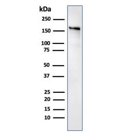 Western blot testing of human kidney lysate with ACE antibody. Expected molecular weight 140-170+ kDa depending on glycosylation level.