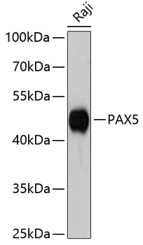 Anti-PAX5 Antibody