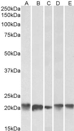 Anti-Ferritin Light Chain Antibody