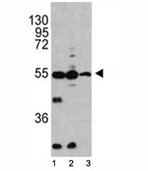 Western blot analysis of Caspase-2 antibody and 1) HL-60, 2) K562, 3) Ramos lysate.