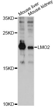 Anti-LMO2 Antibody