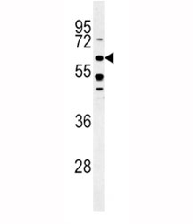 ALK3 western blot analysis in HeLa lysate