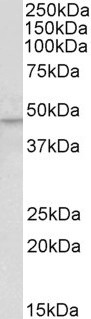 Anti-KLF15 Antibody
